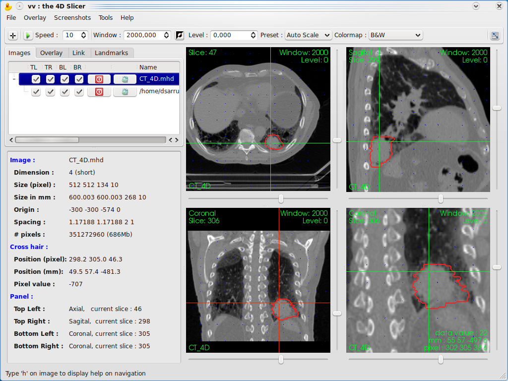 GitHub - open-vv/vv: A Fast And Simple 4D Image Viewer