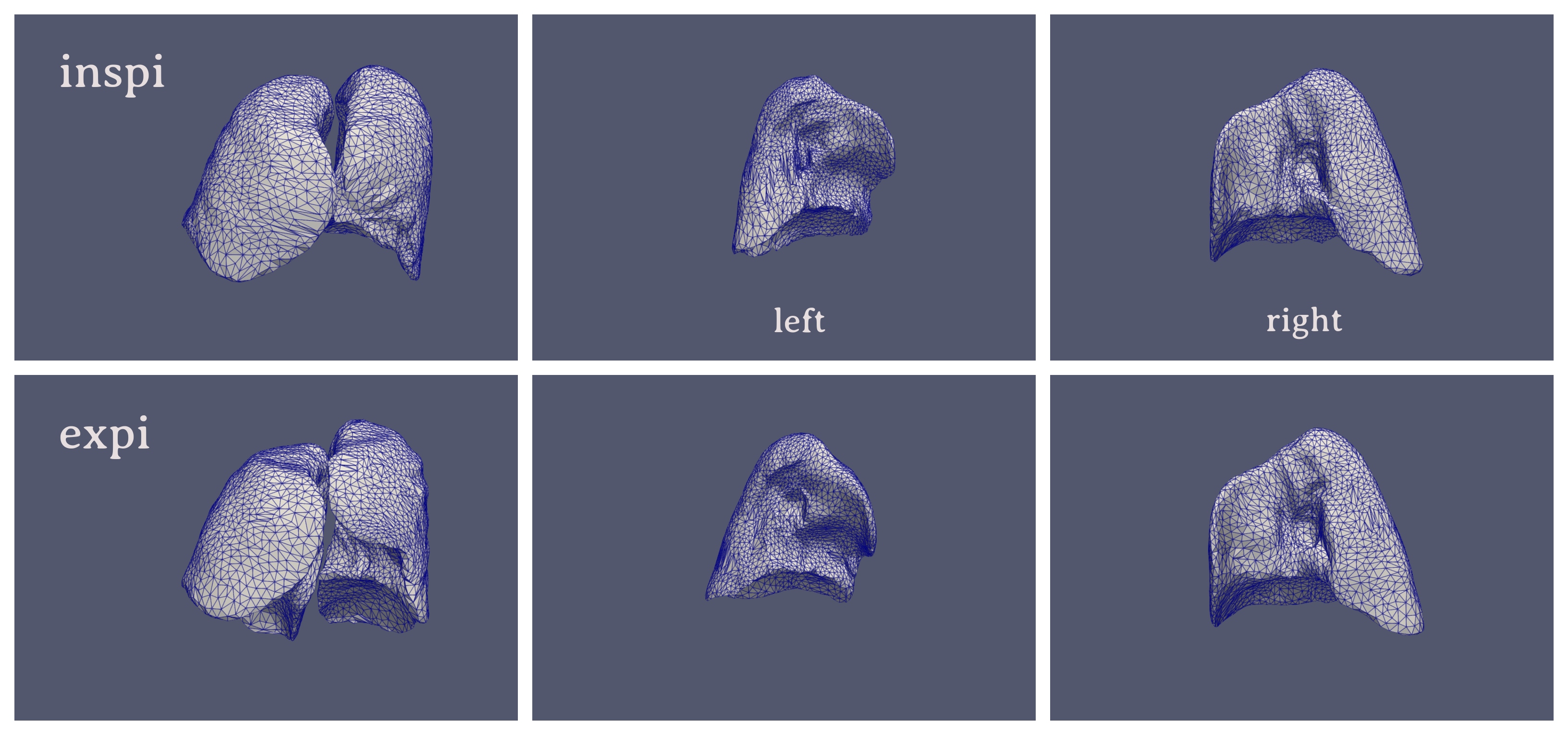 Lung atlas learned from our database