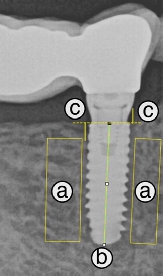 Methodology for MBL measurement