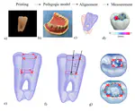 Spatial Abilities and Endodontic Access Cavity Preparation: Implications for Dental Education